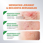 [NEW UPGRADED] YOU AcnePlus Spot Care Pro Serum Obat Totol Jerawat Obat Jerawat Obat Bekas Jerawat