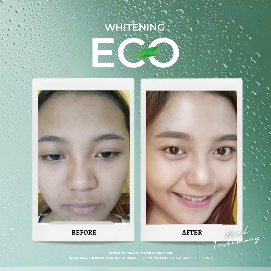 Personal Beauty Set Whitening Eco – Perawatan Wajah Cerah Glowing | Sabun Wajah + Day Cream + Night Cream | Mencerahkan 5x Lebih Cepat Dalam 14 Hari