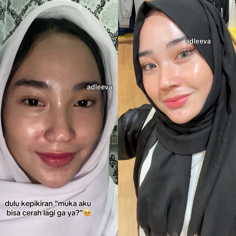 ADLEEVA Paket Hemat Whitening Glow Booster Series “COMPLETE” (Paket Isi 5)