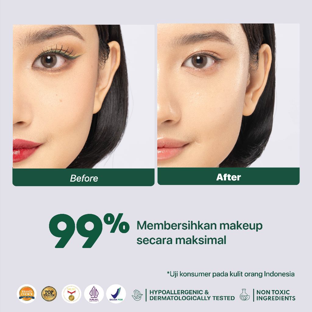 NPURE Acne Power Clear Micellar Water 100ml / Micellar No Alcohol / SLS Free 100ml / Travel Size