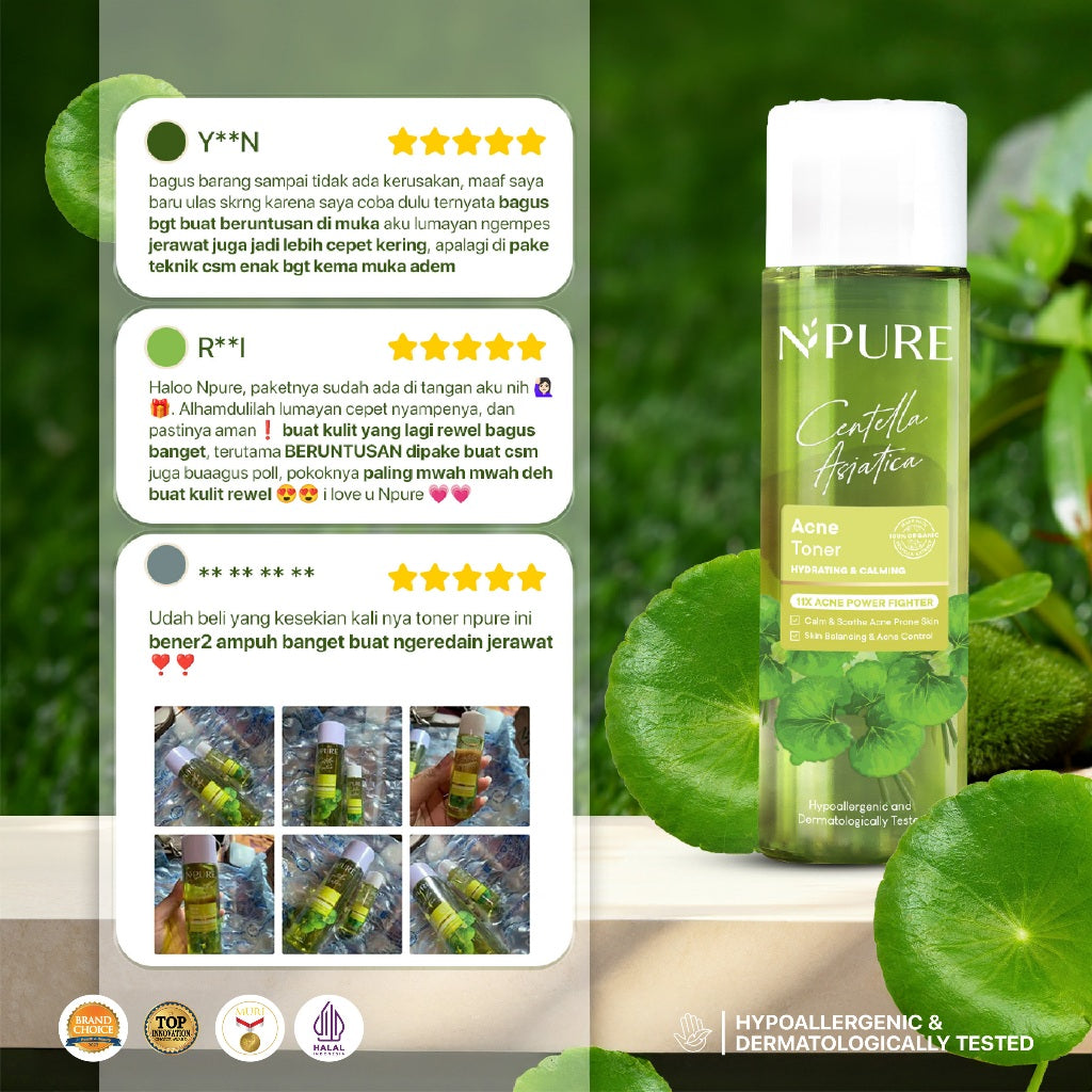 NPURE Cica Hydrating Acne Toner 150 ml / Hydrating Toner / Acne Toner / Toner Kulit Jerawat Berminyak  / Mencerahkan /  Beruntusan