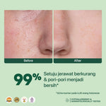NPURE Cica Hydrating Acne Toner 30ml / Acne Toner / Toner Kulit Jerawat Berminyak - Travel Size Acid Berjerawat Hydrating Mencerahkan Wajah Kotoran