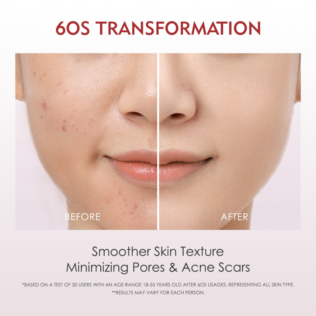 ELFORMULA Intensive Peeling Solution - Peeling Serum Dark Spot Glass Skin Eksfoliasi Wajah Mengangkat Sel Kulit Mati AHA BHA PHA Glowing Smooth Skin Mencerahkan Kulit Halus Blackhead Brightening Whitening Exfoliasi Exfoliating
