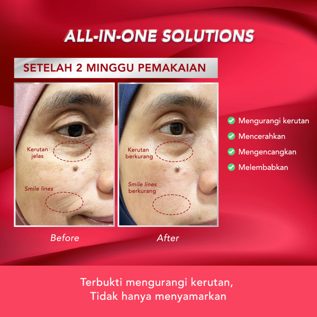 ERHA Age Corrector Serum Peptides & Soya Phytoplacenta for Well-Aging | Mengurangi Garis Halus Kerutan | Melembabkan | Boost Kolagen | Mencerahkan Flek Hitam | Glowing Plumpy | Anti Aging | Kenyal Kencang Cerah
