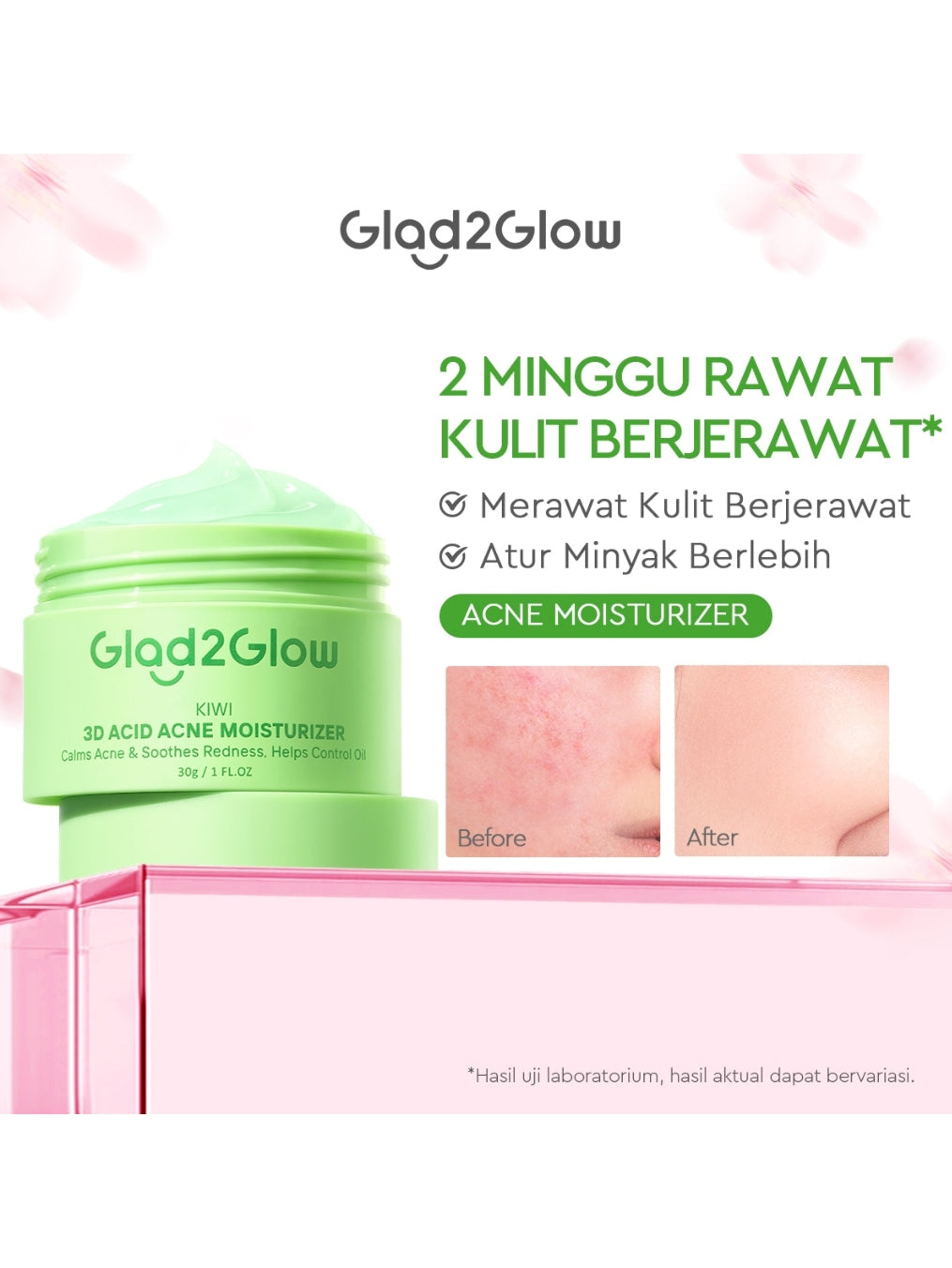Glad2Glow Moisturizer Series Mencerahkan Pencerah Wajah Anti Jerawat Penuaan Hilangkan Flek Tenangkan Kulit Niacinamide 377 Retinol Centella Skincare Pelembab Esensi Perawatan Kulit Pelembab Wajah Pembersih day cream tone up g2g official store