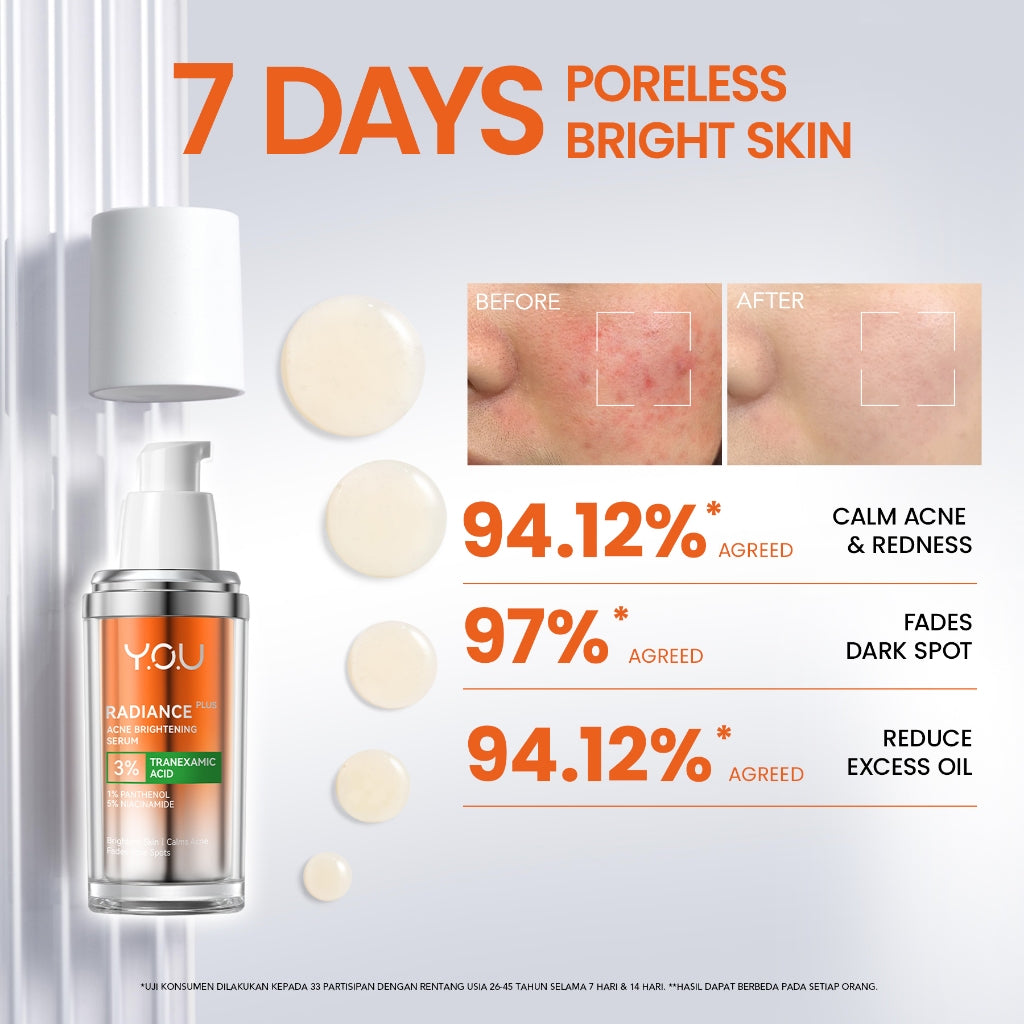 [NEW RADIANCE SERIES] YOU Radiance Plus Acne Brightening Serum | YOU Radiance Glow Illuminating Serum | YOU Radiance UP! Spotless Brightening Serum