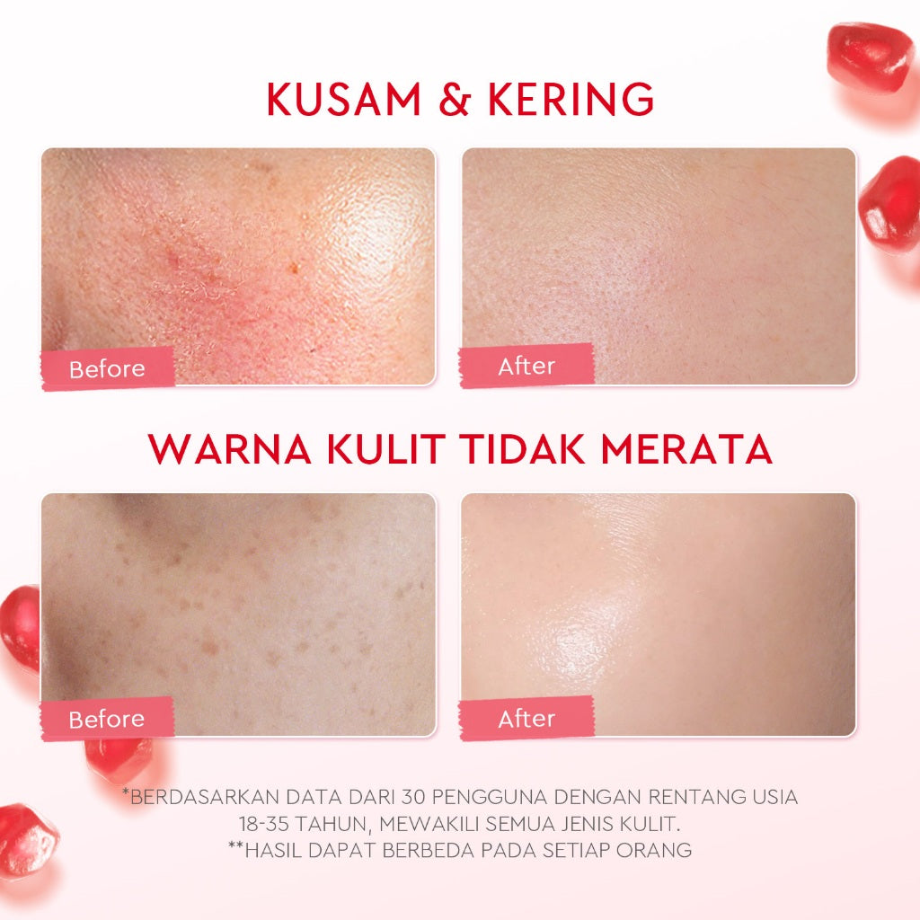 [Isi Besar Hemat]Glad2Glow Pomegranate Niacinamide Brightening Moisturizer 100g Mencerahkan Pemutih Kulit Gel Pelembab Bercahaya Krim Siang dan Malam Perawatan Kulit Ekstrak Delima Asam Lemak Asam Delima Pelembab Esensi Wajah Perawatan g2g official store