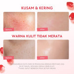 [Isi Besar Hemat]Glad2Glow Pomegranate Niacinamide Brightening Moisturizer 100g Mencerahkan Pemutih Kulit Gel Pelembab Bercahaya Krim Siang dan Malam Perawatan Kulit Ekstrak Delima Asam Lemak Asam Delima Pelembab Esensi Wajah Perawatan g2g official store