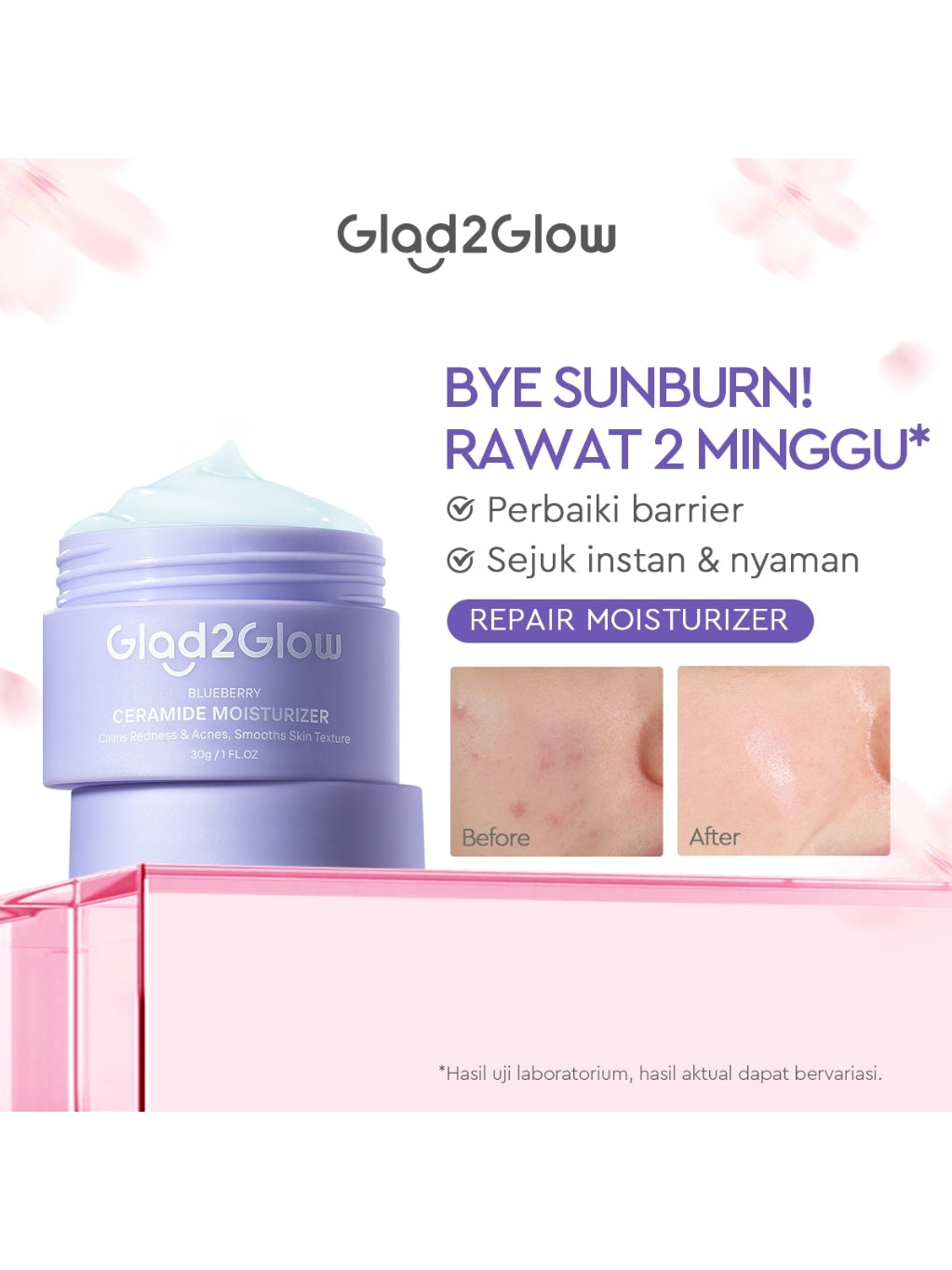 Glad2Glow Moisturizer Series Mencerahkan Pencerah Wajah Anti Jerawat Penuaan Hilangkan Flek Tenangkan Kulit Niacinamide 377 Retinol Centella Skincare Pelembab Esensi Perawatan Kulit Pelembab Wajah Pembersih day cream tone up g2g official store
