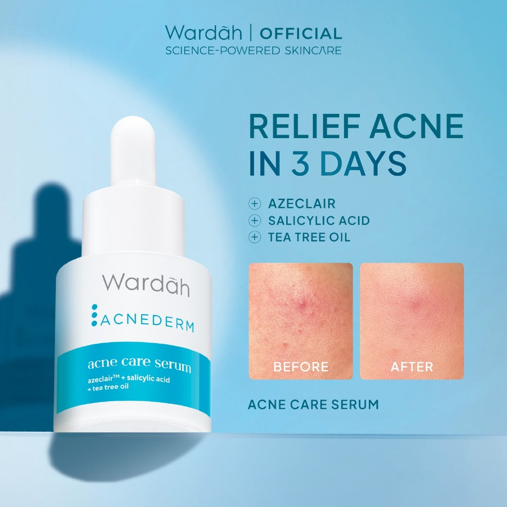WARDAH Serum Complete Series For Every Skin Concern - Exosome PDRN Serum Tosca, Retinal Serum Silver, Acnederm, C-Defense, Lightening, Crystal Secret, Renew You, Hydra Rose, Symradiance 399, Perfectyl Perfect Bright, Peeling Exfoliating Serum - Skincare