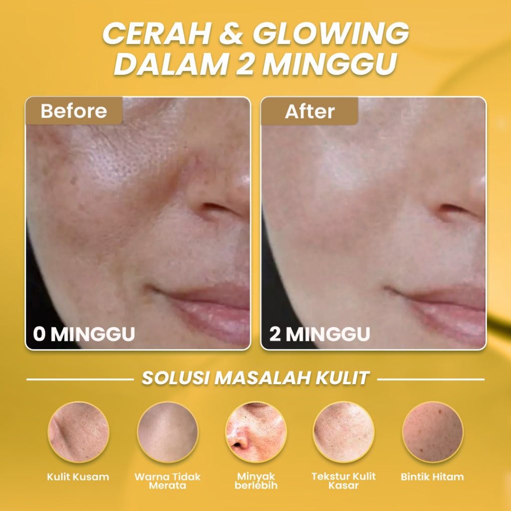 Hanasui Whitening Gold Serum - Cerah & Glowing Kurangi Bintik Hitam & Lawan Tanda Penuaan 4% Niacinamide & 2% Vitamin C
