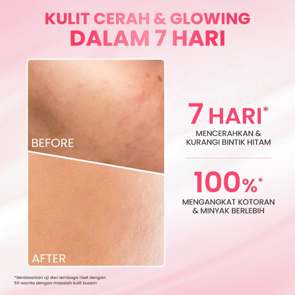 【5pcs Hemat】Hanasui Glow Expert Gentle Cleanser New Improved Formula - Sabun Cuci Muka Foam Cerah & Kurangi Kusam Lembut Tidak Ketarik