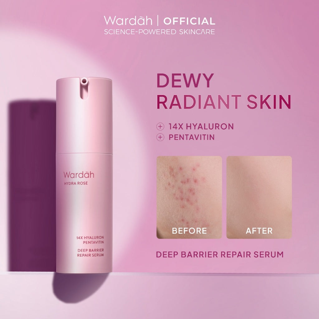 WARDAH Serum Complete Series For Every Skin Concern - Exosome PDRN Serum Tosca, Retinal Serum Silver, Acnederm, C-Defense, Lightening, Crystal Secret, Renew You, Hydra Rose, Symradiance 399, Perfectyl Perfect Bright, Peeling Exfoliating Serum - Skincare