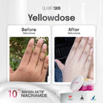 Glawfyskin - Yellow Dose Lotion Whitening 10% Niacinamide