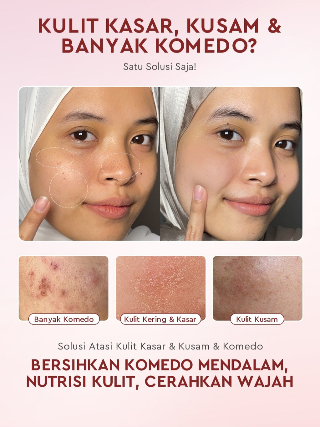 [HEMAT 60K]Glad2Glow Kulit Halus Bundle 7in1 eksfoliasi wajah Skincare Set-Pulihkan/Cerah Krim+Glowing Serum/Peeling Solution+ Cleanser+Eksfoliasi Toner-peeling whitening Moisturizer facial wash Pelembab skincare 1 set lengkap G2G glad2glow official store
