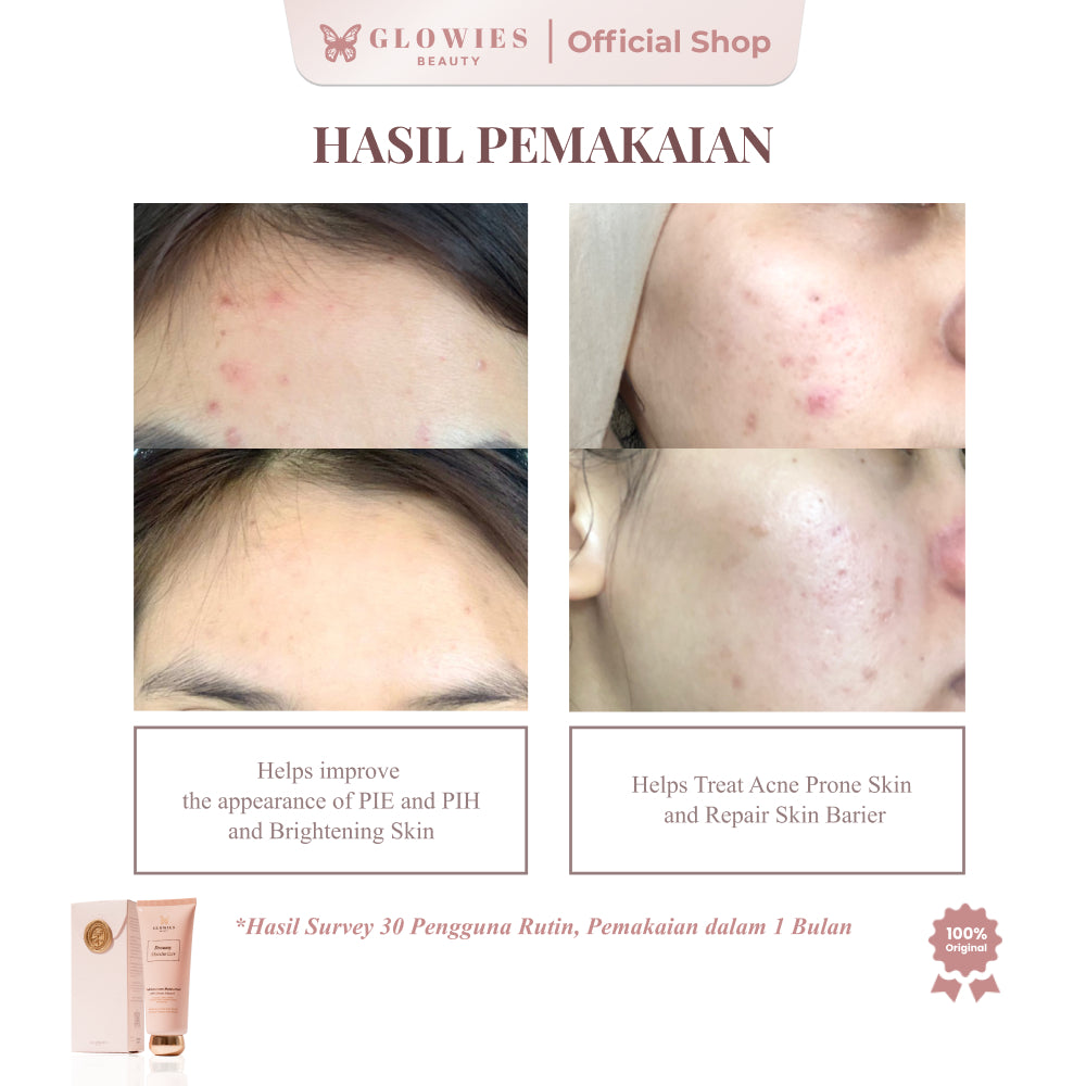 [Dr. Incognito Approved] Glowies Dreamy Moisturizer 80ml Formulasi Korea 7% Azeclair 6% Niacinimide Alpha Arbutin 5x Ceramide Pelembab wajah Busui Friendly membantu Mencerahkan Meratakan Menghilangkan jerawat PIE PIH Memperbaiki Skin Barrier