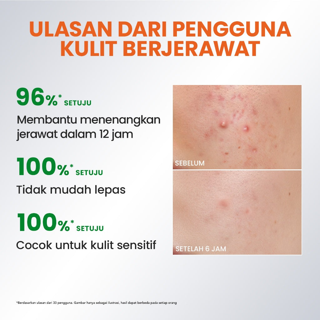 [NEW] YOU AcnePlus BHA Acne Patch Jerawat 5000 ppm Salicylic Acid 36 PCS