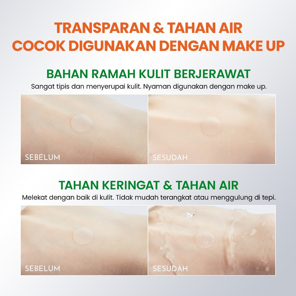 [NEW] YOU AcnePlus BHA Acne Patch Jerawat 5000 ppm Salicylic Acid 36 PCS