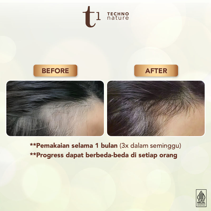 Makarizo T1 Techno Nature Rosemary Scalp & Hair Oil - Rosemary Oil