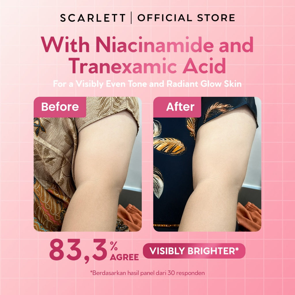 SCARLETT Perfumed Shower Serum 400ml - Brightening, Hydrating, Acne Care | Sabun Mandi Cair untuk Mencerahkan, Melembabkan, Merawat Kulit Berjerawat Jerawat Punggung | Shower Gel Wangi Parfum Mewah Kelas Dunia