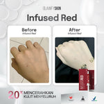Glawfyskin [ Bundling 3pcs ] Infused Red Whitening Essence