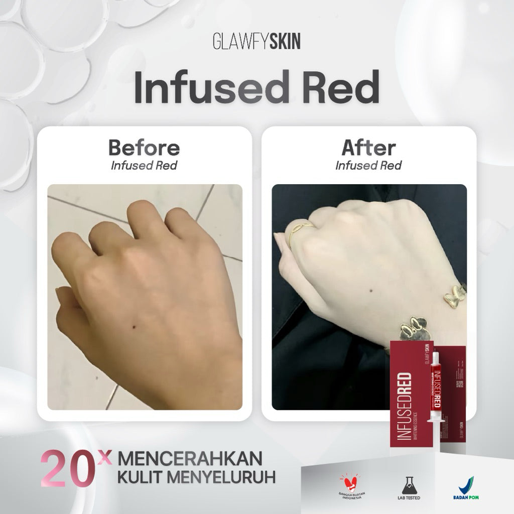 Glawfyskin [ Bundling 3pcs ] Infused Red Whitening Essence
