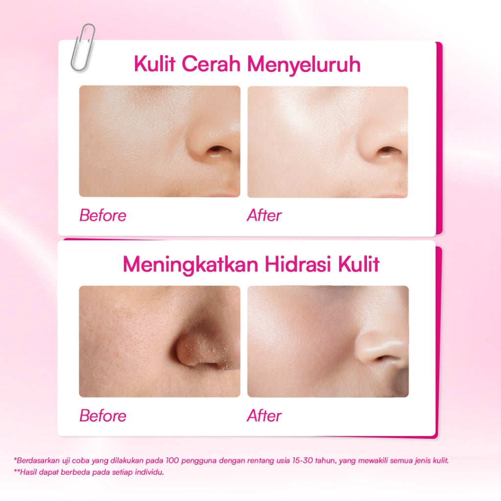 Glowsophy Watermelon Brightening Moisturizer Gel 30ml - Pelembab Wajah Ringan Mencerahkan Kulit dan Meratakan Warna Kulit Kusam