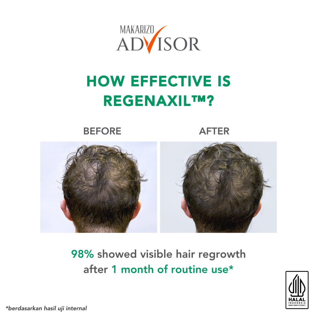 Makarizo Advisor RX Strong Hair Expert Care Series - Atasi Rambut Rontok, Kebotakan Dini, Menumbuhkan Rambut / Non SLS / Silicone-Free