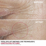 CLARINS Total Eye Lift 15ML - Krim Mata Anti Aging/ Anti Penuaan/ Lingkar Hitam