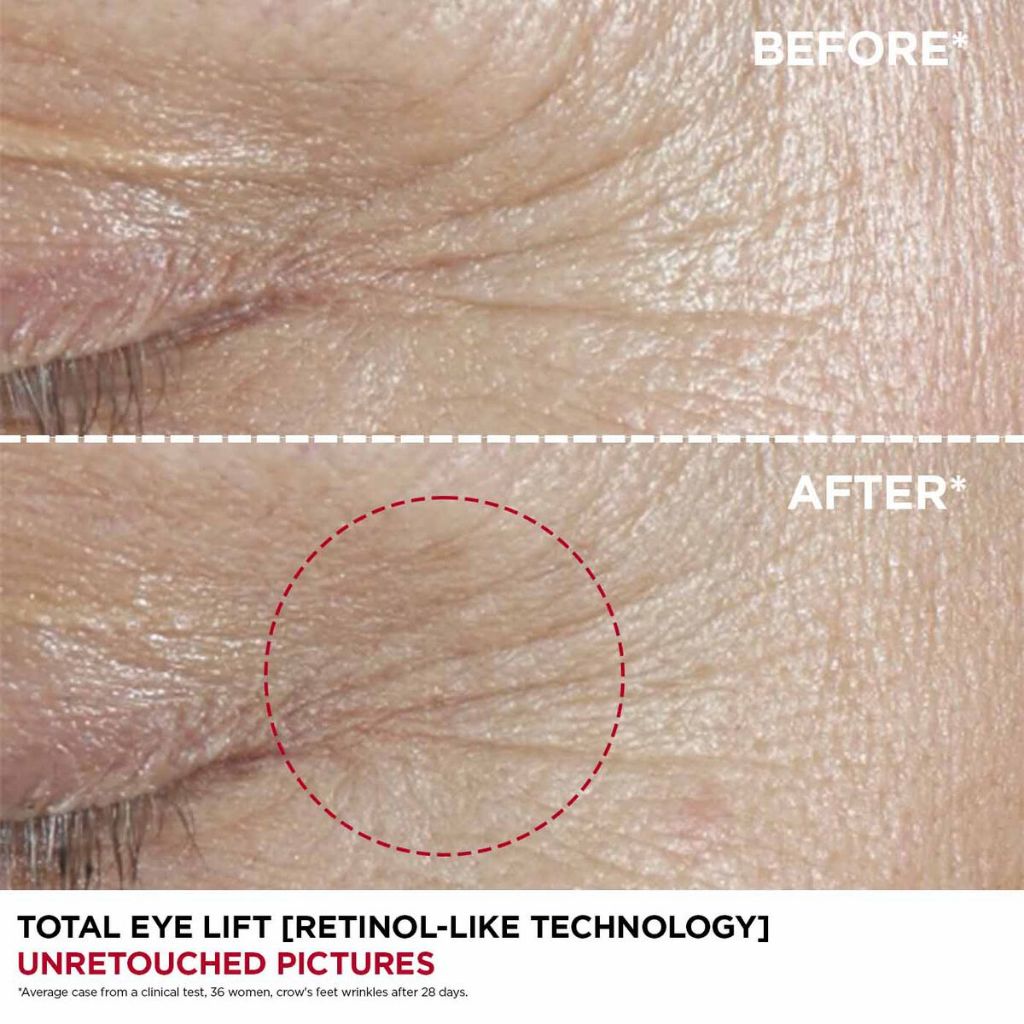 CLARINS Total Eye Lift 15ML - Krim Mata Anti Aging/ Anti Penuaan/ Lingkar Hitam