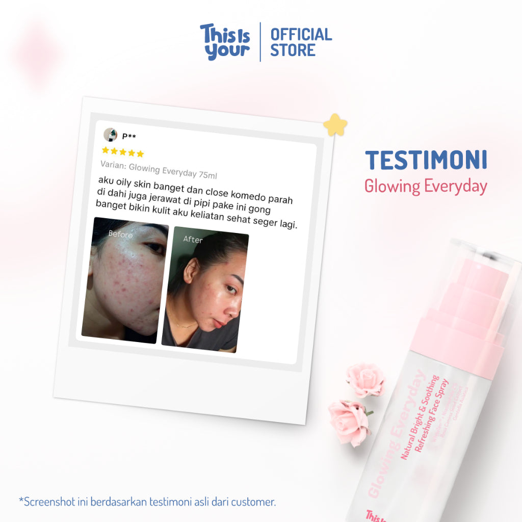 [DR. ABELINA APPROVED] This is Your - Glowing Everyday Shooting Refreshing Face Spray 75ml | Mengandung 2% Niacinamide, Rosa Canina, Centella Asiatica | Membantu Mencerahkan Wajah Cocok Untuk Kulit Kering, Berjerawat, dan Kusam