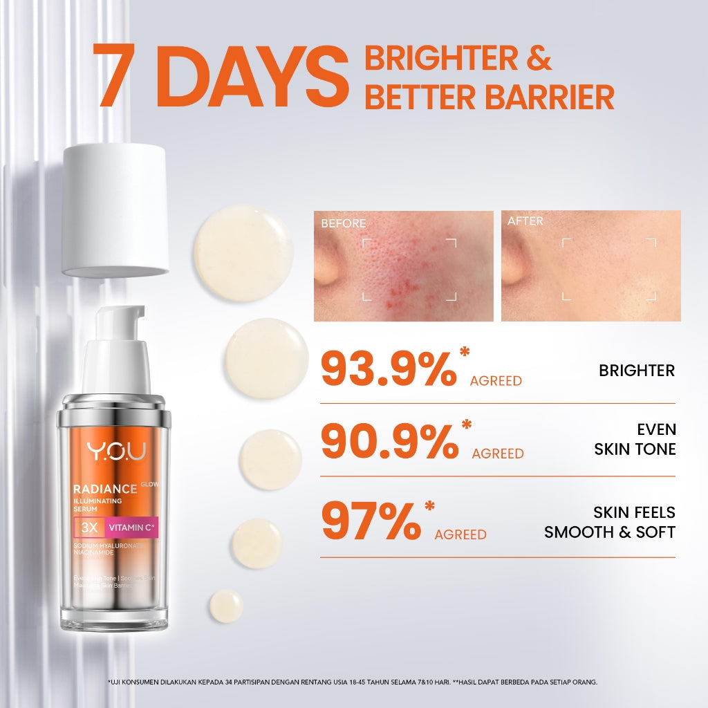 [NEW RADIANCE SERIES] YOU Radiance Plus Acne Brightening Serum | YOU Radiance Glow Illuminating Serum | YOU Radiance UP! Spotless Brightening Serum