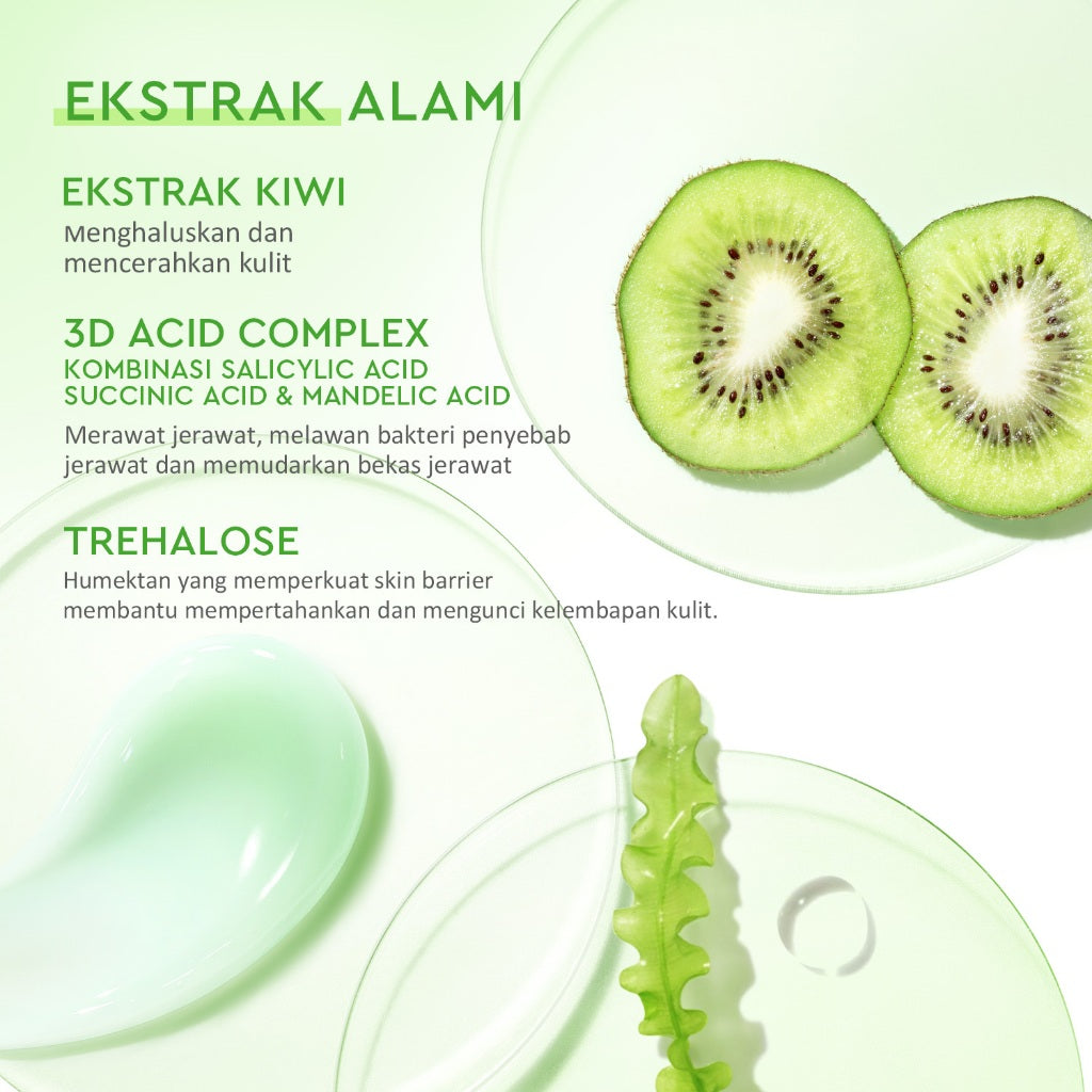 [BIG MOIST] GLAD2GLOW Kiwi 3D Acid Acne Moisturizer 100g Pelembab Wajah Jerawat Mencerahkan Pencerah Wajah&Penuaan Hilangkan Flek & Tenangkan Kulit Skincare Pelembab Esensi Wajah Perawatan Kulit Pelembab Wajah Pembersih day cream tone up g2g officialstore