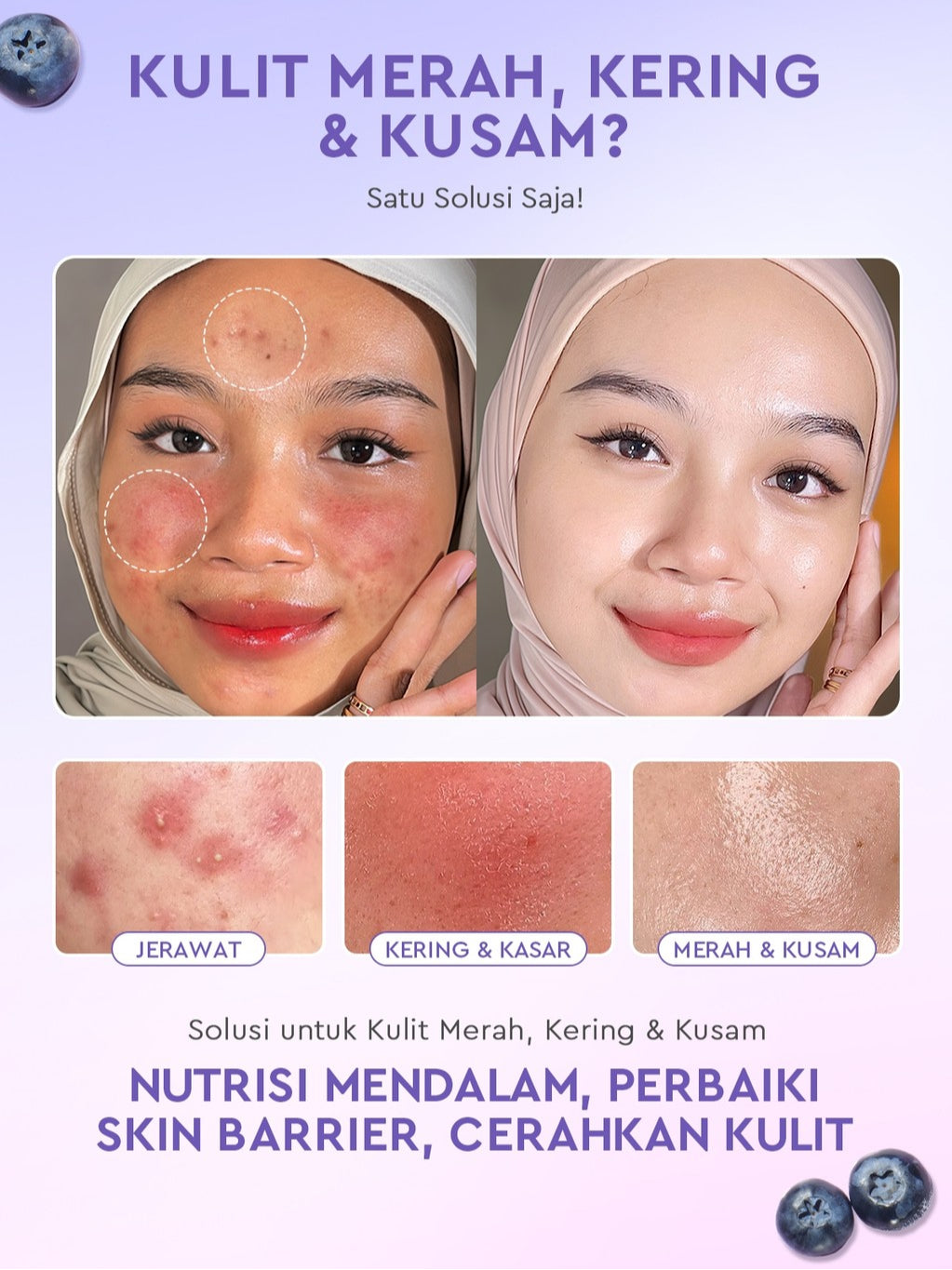 Glad2Glow Cerah&Pulihkan Bundle all in 1 7in1 Glowing skincare Brightening Set-Pulihkan/Cerah Krim+Cerah/kulit halus Serum+Pulihkan cleanser+Cerah Toner whitening Moisturizer facial wash Pelembab skincare 1 set lengkap G2G glad2glow official store