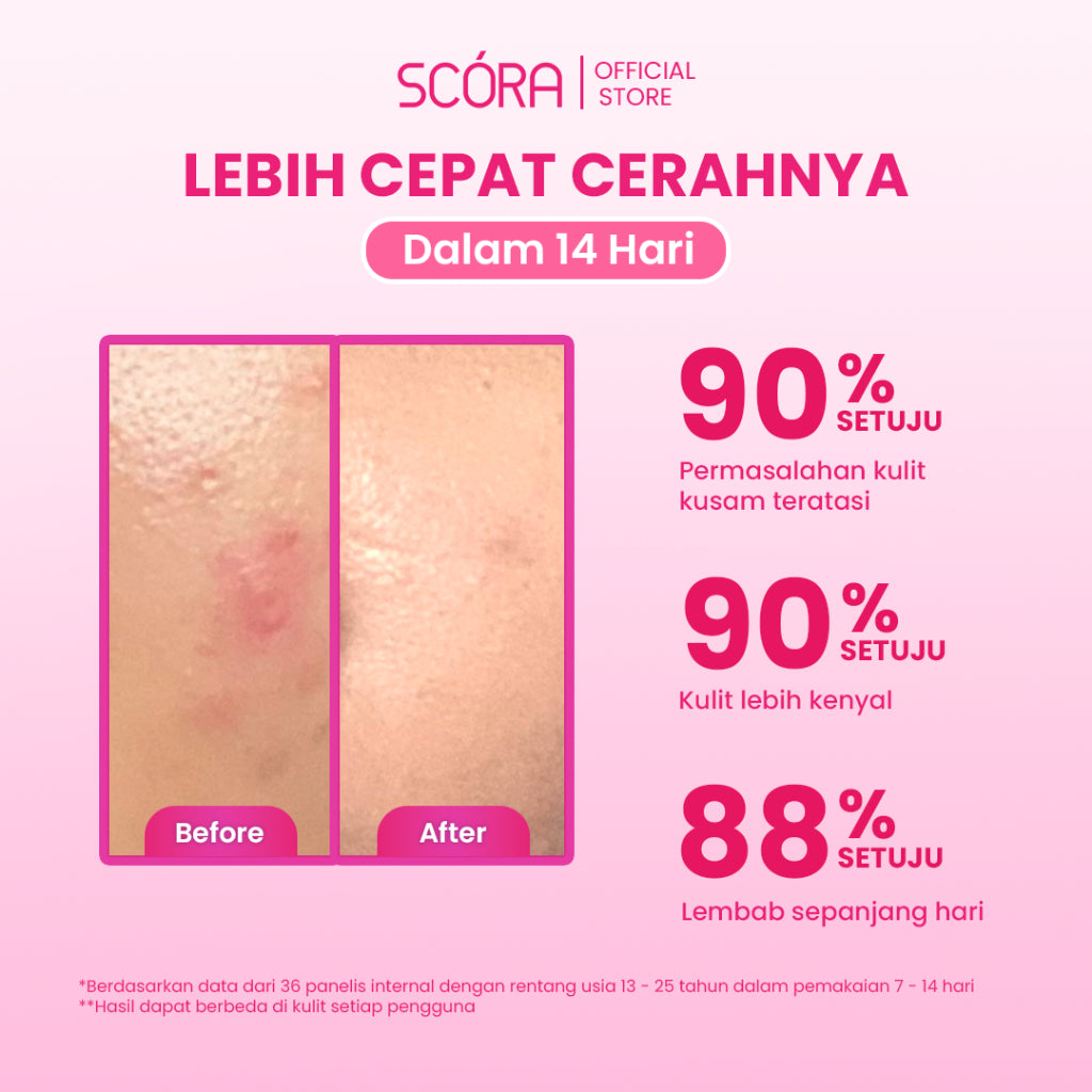 [NEW PACKAGING] SCORA 5% Niacinamide Hydramoist Gel with Alpha Arbutin & Panthenol 45ML Mencerahkan Melembapkan Kulit