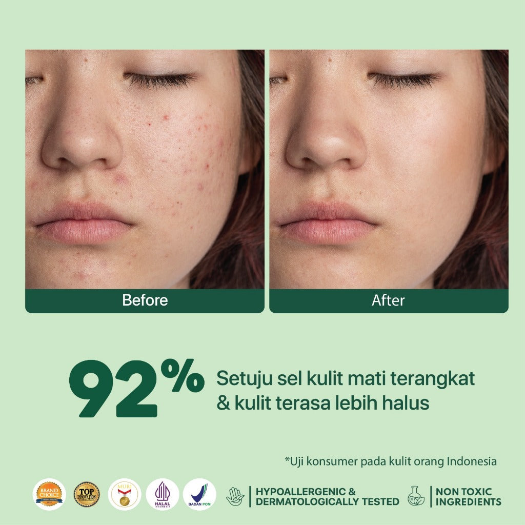 NPURE Gentle Exfoliation Pad / Acne Clear Pad Cica / Kapas Eksfoliasi Kulit Jerawat / Acne Exfoliating Pad (40 pads) Acid Extract Glycolic Pha Wajah Bruntusan