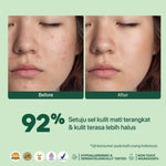 GENTLE EXFOLIATION PAD CICA  -  NPURE Acne Clear Pad Cica / Kapas Eksfoliasi Kulit Jerawat / Acne Exfoliating Pad (40 pads) Acid Extract Glycolic Pha Wajah Bruntusan