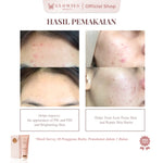 FLASH SALE Glowies Beauty Dreamy Moisturizer Skincare Repair Skin Barrier Melembapkan dan Meredakan Jerawat PIE/PIH with 7% Azeclair 6% Niacinamide Tranexamic Acid Alpha Arbutin Acne Calming Water Gel