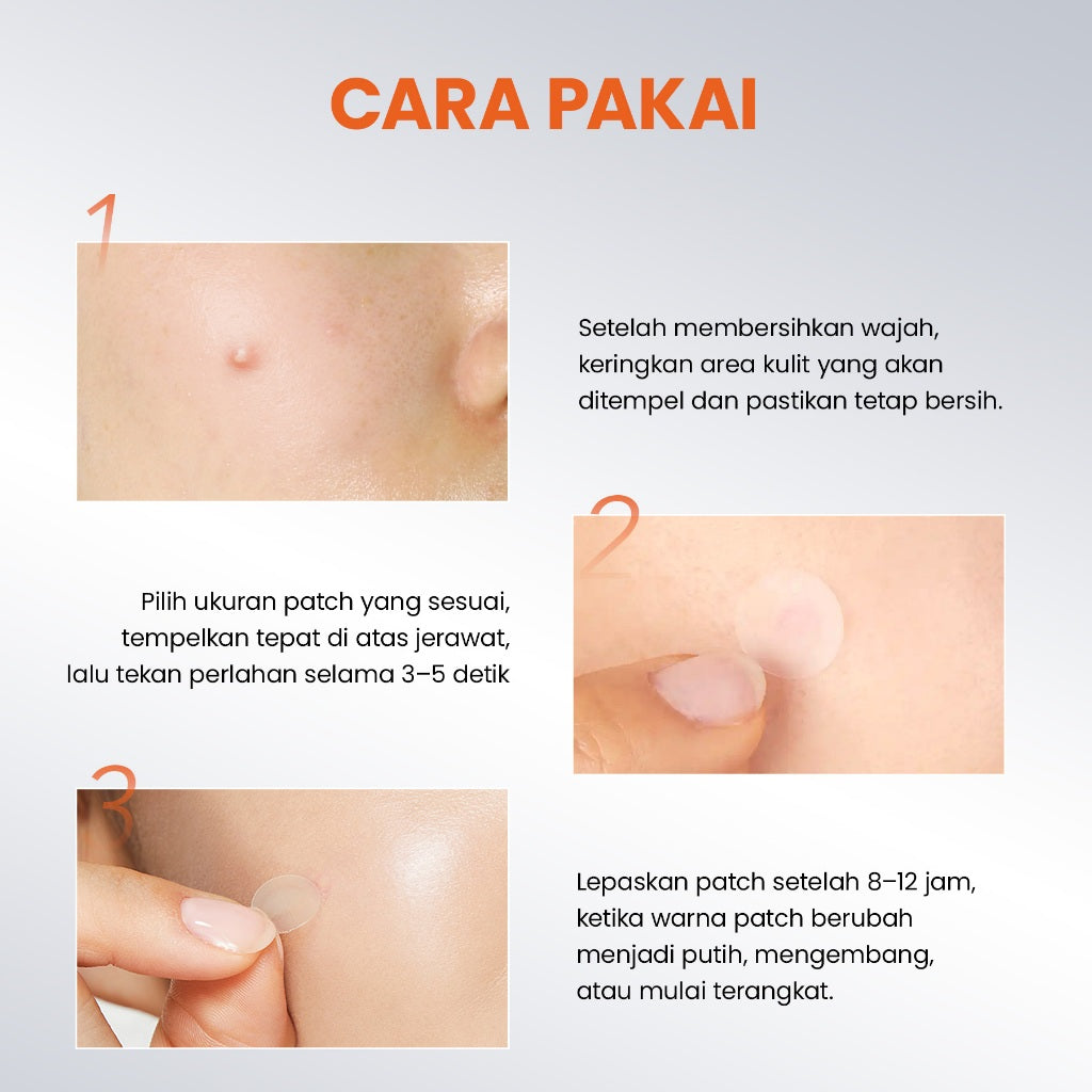 [NEW] YOU AcnePlus BHA Acne Patch Jerawat 5000 ppm Salicylic Acid 36 PCS