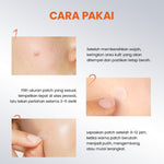 [NEW] YOU AcnePlus BHA Acne Patch Jerawat 5000 ppm Salicylic Acid 36 PCS