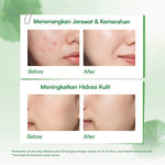 Glowsophy Bundle 2in1 Glow Skin CICA Centella Soothing Moisturizer 100 ml + Pineapple Triple-C Glow and Bright Serum 30 ml