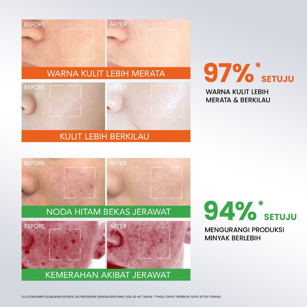 [NEW] YOU Radiance Plus Acne Brightening Serum | Tranexamic Acid | Niacinamide | Serum jerawat PIE PIH Kulit Berminyak dan Pori Besar