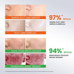 [NEW] YOU Radiance Plus Acne Brightening Serum | Tranexamic Acid | Niacinamide | Serum jerawat PIE PIH Kulit Berminyak dan Pori Besar