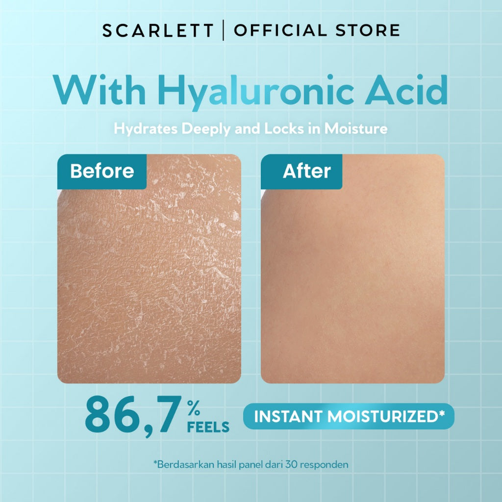 SCARLETT Perfumed Shower Serum 400ml - Brightening, Hydrating, Acne Care | Sabun Mandi Cair untuk Mencerahkan, Melembabkan, Merawat Kulit Berjerawat Jerawat Punggung | Shower Gel Wangi Parfum Mewah Kelas Dunia