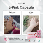 Glawfyskin [ 3 BOX ] L-Pink Capsule | Suplement Kulit |  Booster Capsule | Capsule Kesehatan Kulit BPOM