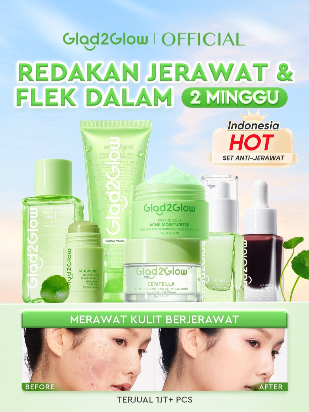 [ORDER NOW, HEMAT 50K]Glad2Glow Acne Jerawat Bundle 7in1 paket Centella madeca cream-Moisturizer+Serum+Cleanser+Toner+Clay Stick+Gel Skincare  Mask Menghilangkan Menenangkan kemerahan pada kulit Atur Minyak BerlebihMerawat Kulit g2glow official store