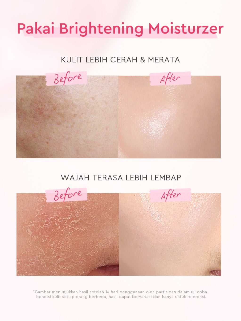 [Cocok Untuk Pemula] Glad2Glow Cerah Glowing Bundle 4in1-Brightening Moisturizer+Serum+Cleanser+toner+Peeling solution+Retinol 10%Niacinamide skincare paket pembersih perawatan kulit mencerahkan warna kulit pelembab wajah all in 1g2glow official store