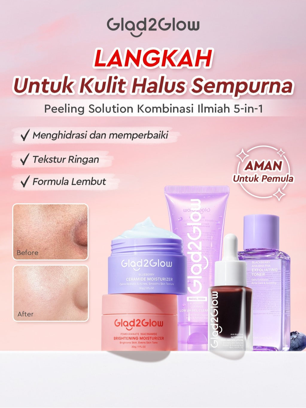 [Set Eksfoliasi]Glad2Glow Kulit Halus Bundle all in 1 - 2/3/4/5 PCS eksfoliasi wajah Skincare Set-Pulihkan/Cerah Krim+Peeling Solution+ Cleanser+Eksfoliasi Toner-peeling whitening Moisturizer facial wash Pelembab G2G glad2glow official store