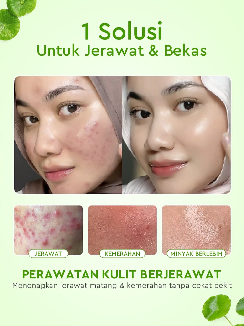 [ORDER NOW, HEMAT 50K]Glad2Glow Acne Jerawat Bundle 7in1 paket Centella madeca cream-Moisturizer+Serum+Cleanser+Toner+Clay Stick+Gel Skincare  Mask Menghilangkan Menenangkan kemerahan pada kulit Atur Minyak BerlebihMerawat Kulit g2glow official store