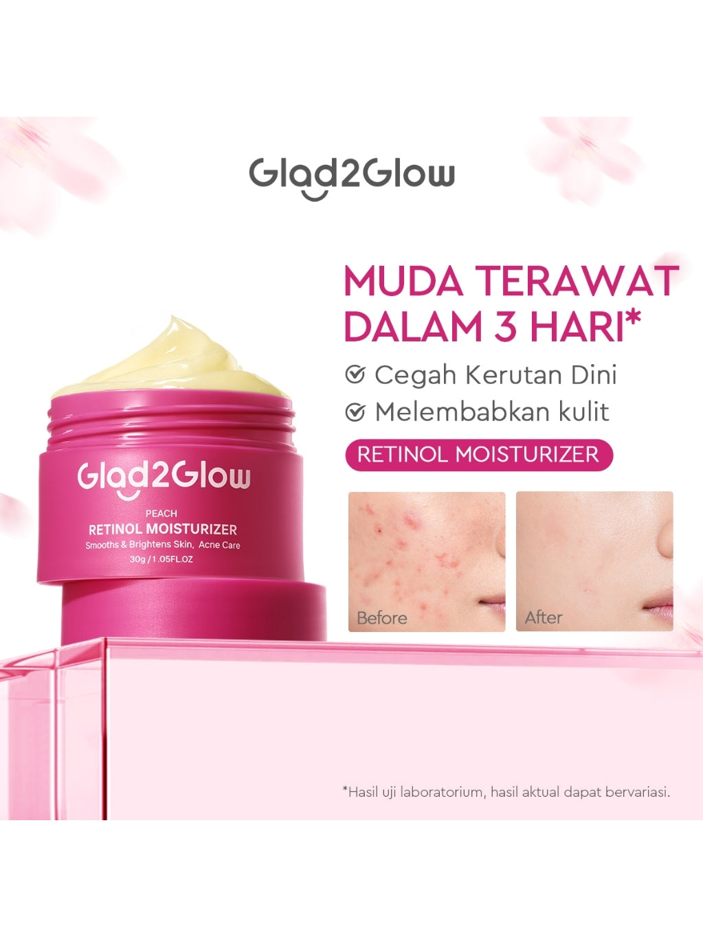 Glad2Glow Moisturizer Series Mencerahkan Pencerah Wajah Anti Jerawat Penuaan Hilangkan Flek Tenangkan Kulit Niacinamide 377 Retinol Centella Skincare Pelembab Esensi Perawatan Kulit Pelembab Wajah Pembersih day cream tone up g2g official store